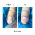 NAILSOFTHEDAY ONISTOP – регенеруюча олія для нігтів з оніхолізисом, 15 ml