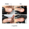 NAILSOFTHEDAY ONISTOP – регенеруюча олія для нігтів з оніхолізисом, 15 ml