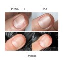 NAILSOFTHEDAY ONISTOP – olejek regenerujący dla paznokci z onycholizą, 15 ml