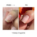 NAILSOFTHEDAY ONISTOP – olejek regenerujący dla paznokci z onycholizą, 15 ml