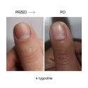 NAILSOFTHEDAY ONISTOP – regenerating oil for nails with onycholysis, 15 ml